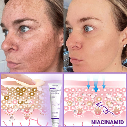 Vitalisys®🍃PDRN Multi-Peptide Masážní tělový krém s válečkem — proti stárnutí, hydratuje, zpevňuje a liftinguje pokožku, podporuje regeneraci, sjednocuje tón pleti a pečuje o nedokonalosti a tmavé skvrny.