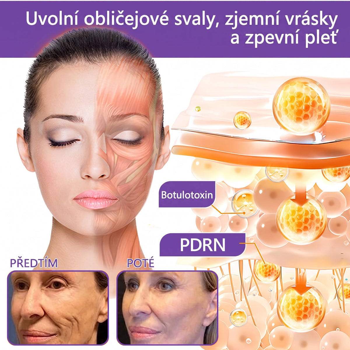 Vitalisys®🍃PDRN Multi-Peptide Masážní tělový krém s válečkem — proti stárnutí, hydratuje, zpevňuje a liftinguje pokožku, podporuje regeneraci, sjednocuje tón pleti a pečuje o nedokonalosti a tmavé skvrny.