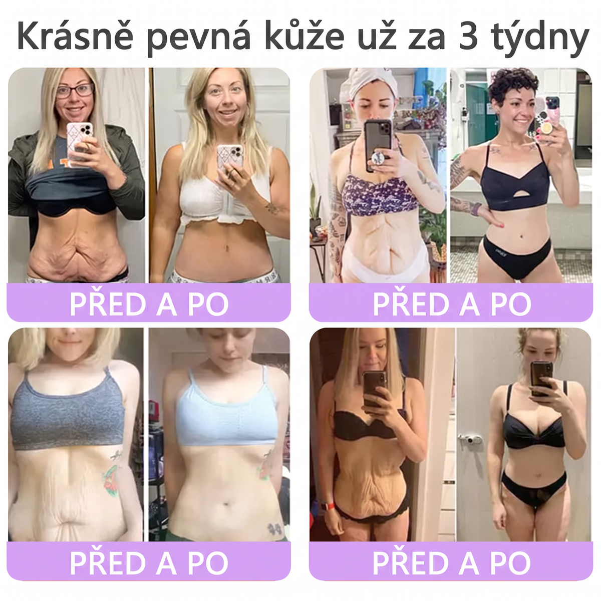 Vitalisys®🍃PDRN Multi-Peptide Masážní tělový krém s válečkem — proti stárnutí, hydratuje, zpevňuje a liftinguje pokožku, podporuje regeneraci, sjednocuje tón pleti a pečuje o nedokonalosti a tmavé skvrny.