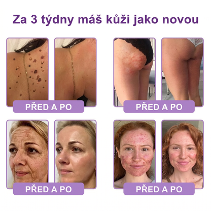 Vitalisys®🍃PDRN Multi-Peptide Masážní tělový krém s válečkem — proti stárnutí, hydratuje, zpevňuje a liftinguje pokožku, podporuje regeneraci, sjednocuje tón pleti a pečuje o nedokonalosti a tmavé skvrny.
