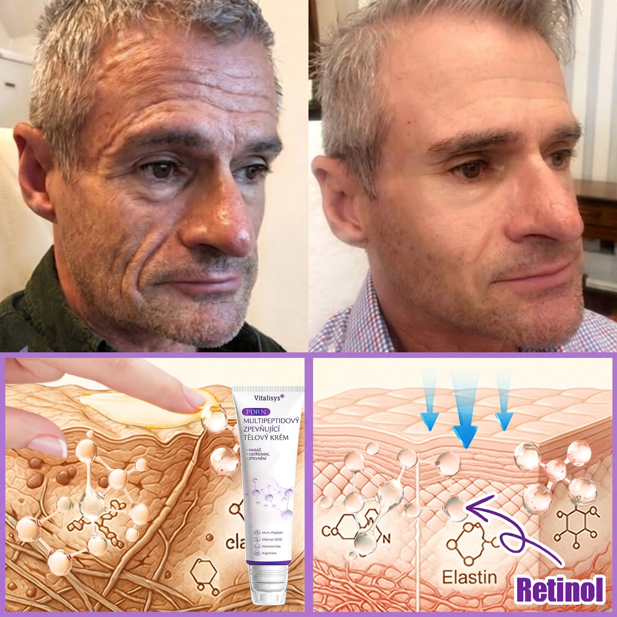 Vitalisys®🍃PDRN Multi-Peptide Masážní tělový krém s válečkem — proti stárnutí, hydratuje, zpevňuje a liftinguje pokožku, podporuje regeneraci, sjednocuje tón pleti a pečuje o nedokonalosti a tmavé skvrny.